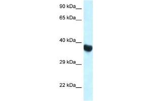WB Suggested Anti-Hoxa10 Antibody Titration: 1. (HOXA10 Antikörper  (C-Term))