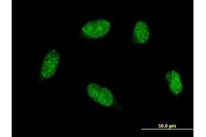 Immunofluorescence of monoclonal antibody to ATOH1 on HeLa cell. (ATOH1 Antikörper  (AA 266-354))