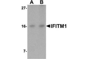 Western blot analysis of IFITM1 in Jurkat cell lysate with IFITM1 antibody at (A) 2. (IFITM1 Antikörper  (C-Term))
