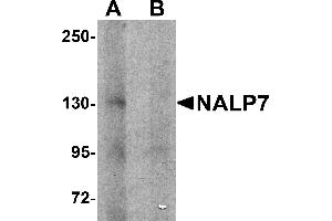 Western Blotting (WB) image for anti-NLR Family, Pyrin Domain Containing 7 (NLRP7) (N-Term) antibody (ABIN1031472) (NLRP7 Antikörper  (N-Term))