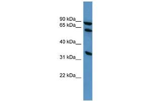 WB Suggested Anti-ELMO1 Antibody Titration: 0. (ELMO1 Antikörper  (C-Term))