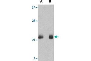 Western blot analysis of FGF4 in NIH NIH/3T3 cell lysate with FGF4 polyclonal antibody  at (A) 0. (FGF4 Antikörper  (C-Term))