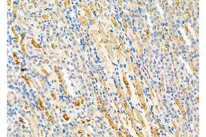 ABIN6264562 and ABIN6279729 at 1/100 staining Rat kidney tissue by IHC-P. (RAB1B Antikörper  (Internal Region))