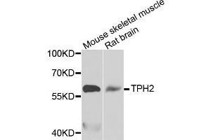 Western blot analysis of extracts of mouse skeletal muscle tissues, using TPH2 antibody.