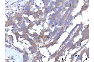 IHC analysis of RAP1GAP using anti-RAP1GAP antibody (ABIN7599729). (RAP1GAP Antikörper  (AA 11-661))