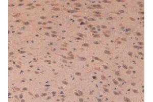 IHC-P analysis of Mouse Brain Tissue, with DAB staining. (IGFBP7 Antikörper  (AA 88-281))