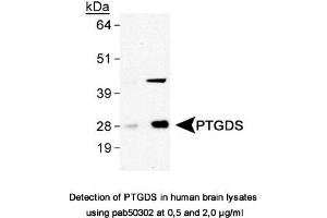 Image no. 1 for anti-Prostaglandin D2 Synthase (PTGDS) antibody (ABIN363611) (PTGDS Antikörper)