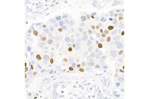 Immunohistochemistry (IHC) image for anti-Progesterone Receptor (PGR) antibody (ABIN7269533)
