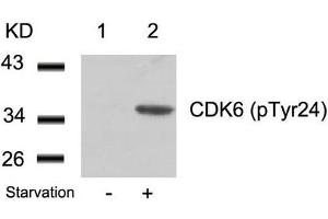 Western blot analysis of extracts from 293 cells untreated(lane 1) or treated with starvation(lane 2) using CDK6(phospho-Tyr24) Antibody. (CDK6 Antikörper  (pTyr24))