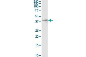 C20orf77 monoclonal antibody (M04), clone 4D6. (RPRD1B Antikörper  (AA 1-326))