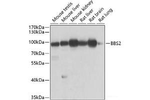 Western blot analysis of extracts of various cell lines using BBS2 Polyclonal Antibody at dilution of 1:1000. (BBS2 Antikörper)