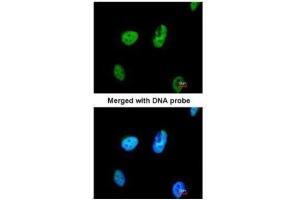 ICC/IF Image Immunofluorescence analysis of paraformaldehyde-fixed HeLa, using TATDN1, antibody at 1:200 dilution. (TATDN1 Antikörper  (Center))