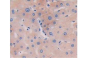 Used in DAB staining on fromalin fixed paraffin- embedded liver tissue (Biliverdin Reductase Antikörper  (AA 1-125))