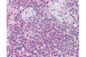 Anti-IRAK4 antibody IHC of human spleen. (IRAK4 Antikörper  (C-Term))