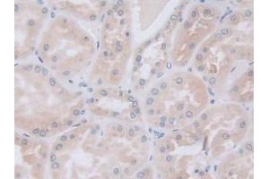 Detection of GLa in Human Kidney Tissue using Polyclonal Antibody to Galactosidase Alpha (GLa) (GLA Antikörper  (AA 81-429))