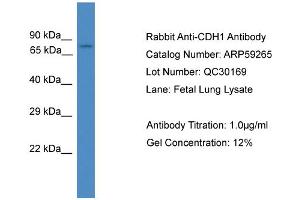 Western Blotting (WB) image for anti-Cadherin 1, Type 1, E-Cadherin (Epithelial) (CDH1) (Middle Region) antibody (ABIN2787999)