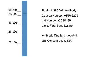 WB Suggested Anti-CDH1  Antibody Titration: 0. (E-cadherin Antikörper  (Middle Region))