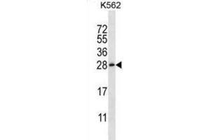 Western Blotting (WB) image for anti-Chorionic Somatomammotropin Hormone-Like 1 (CSHL1) antibody (ABIN2997108) (CSHL1 Antikörper)