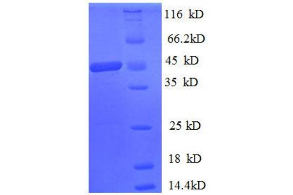 SAT1 Protein (AA 5-171) (GST tag)