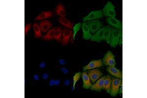 ABIN6257094 and ABIN6275278 staining Hela cells by IF/ICC. (CYB5R3 Antikörper  (C-Term))