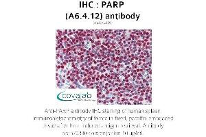 Image no. 3 for anti-Poly (ADP-Ribose) Polymerase 1 (PARP1) antibody (ABIN1723251) (PARP1 Antikörper)