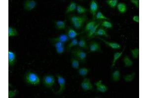 Immunofluorescence staining of A549 cells with ABIN7166440 at 1:100, counter-stained with DAPI. (PORCN Antikörper  (AA 269-332))