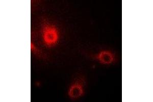 Immunofluorescent analysis of Aminoacylase 1 staining in Hela cells. (Aminoacylase 1 Antikörper)