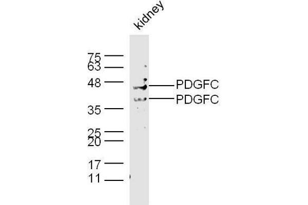 PDGFC Antikörper  (AA 201-300)