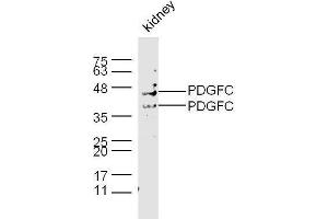 Mouse kidney lysates probed with Rabbit Anti-PDGFC Polyclonal Antibody, Unconjugated  at 1:500 for 90 min at 37˚C. (PDGFC Antikörper  (AA 201-300))