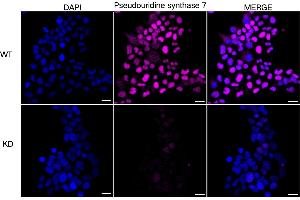 Immunocytochemical staining of HeLa cells using Pseudouridine synthase 7 antibody (ABIN7800059), 1:1,000), Top panel: wild-type (WT), Bottom panal: Pseudouridine synthase 7 shRNA knockdown (KD). (PUS7 Antikörper)