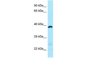 WB Suggested Anti-ABHD6 Antibody Titration: 1. (ABHD6 Antikörper  (C-Term))