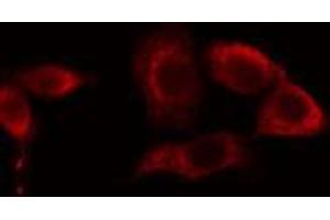ABIN6274656 staining LOVO cells by IF/ICC. (CYP39A1 Antikörper  (C-Term))