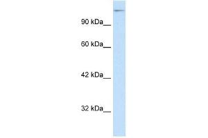 Human HepG2; WB Suggested Anti-SUPT5H Antibody Titration: 0. (SUPT5H Antikörper  (C-Term))