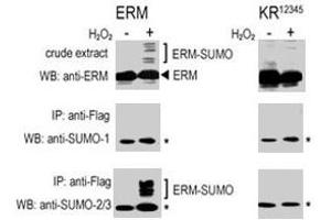COS-7 cells were transfected for 24 hrs with a plasmid expressing FLAG-ERM (left panels) or FLAG-ERM KR12345 (right panels) . (SUMO1 Antikörper  (C-Term))