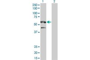Western Blot analysis of SH2B1 expression in transfected 293T cell line by SH2B1 monoclonal antibody (M01), clone 2B9.