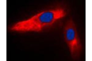 Immunofluorescent analysis of ACTN3 staining in HeLa cells. (ACTN3 Antikörper  (N-Term))