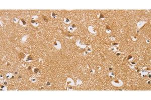 Immunohistochemistry of paraffin-embedded Human brain tissue using ARHGEF1 Polyclonal Antibody at dilution 1:50 (ARHGEF1 Antikörper)