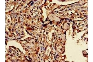 Immunohistochemistry of paraffin-embedded human placenta tissue using ABIN7172536 at dilution of 1:100 (TFEB Antikörper  (AA 1-476))