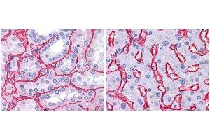 anti collagen IV antibody (600-401-106 Lot 25440, 1:400, 45 min RT) showed strong staining in FFPE sections of human kidney (Left) with strong red staining observed in glomeruli and liver (Right) with strong staining in sinusoids. (Collagen IV Antikörper)