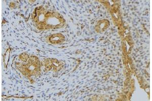 ABIN6276488 at 1/100 staining Human uterus tissue by IHC-P.