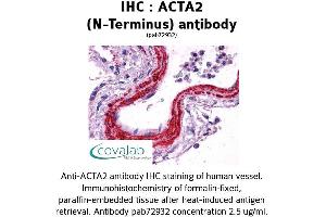 Image no. 1 for anti-Actin, alpha 2, Smooth Muscle, Aorta (ACTA2) (N-Term) antibody (ABIN1731470) (Smooth Muscle Actin Antikörper  (N-Term))