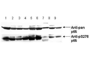 Image no. 4 for anti-Nuclear Factor-kB p65 (NFkBP65) (pSer276) antibody (ABIN1103942) (NF-kB p65 Antikörper  (pSer276))