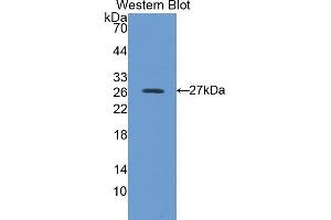 Detection of Recombinant PRDX6, Human using Polyclonal Antibody to Peroxiredoxin 6 (PRDX6) (Peroxiredoxin 6 Antikörper  (AA 1-224))
