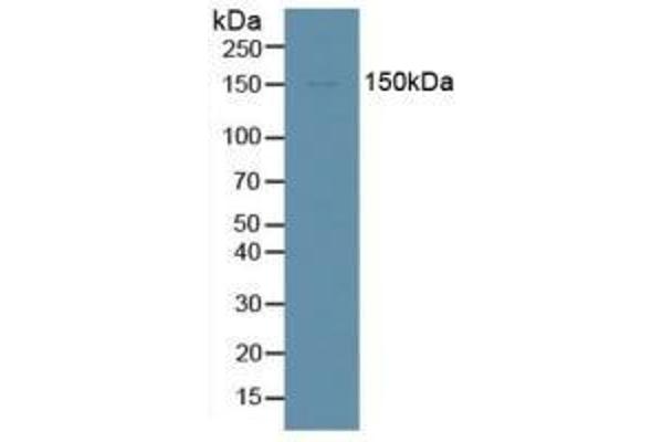 DDX58 Antikörper  (AA 1-211)