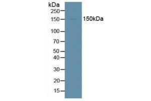 Detection of DDX58 in Human HepG2 Cells using Polyclonal Antibody to Probable ATP-dependent RNA Helicase DDX58 (DDX58)