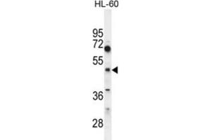 Western Blotting (WB) image for anti-Choline/ethanolamine phosphotransferase 1 (CEPT1) antibody (ABIN2995621) (CEPT1 Antikörper)