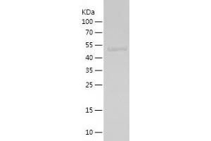 Western Blotting (WB) image for Microspherule Protein 1 (MCRS1) (AA 223-416) protein (His-IF2DI Tag) (ABIN7282321) (MCRS1 Protein (AA 223-416) (His-IF2DI Tag))