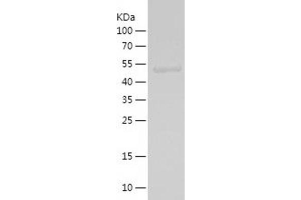 MCRS1 Protein (AA 223-416) (His-IF2DI Tag)