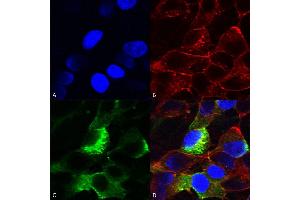 Immunocytochemistry/Immunofluorescence analysis using Mouse Anti-Nav beta3 Monoclonal Antibody, Clone S396-29 (ABIN2485584).