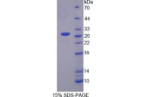 Image no. 1 for Myosin Light Chain Kinase 2 (MYLK2) (AA 330-548) protein (His tag) (ABIN6240008)